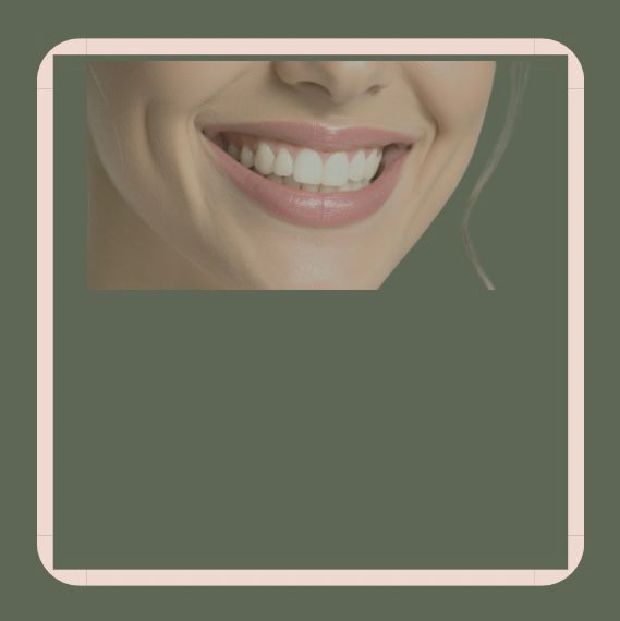 Esthétique du sourire