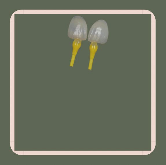 Facettes céramiques