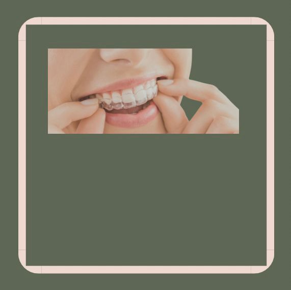 Invisalign