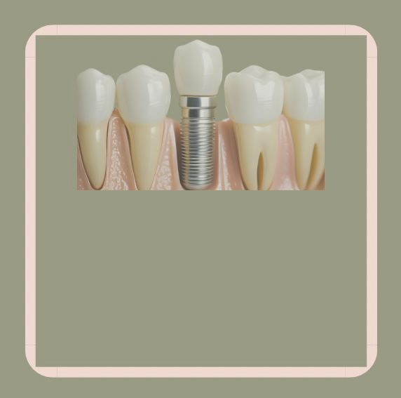Prothèses sur implant