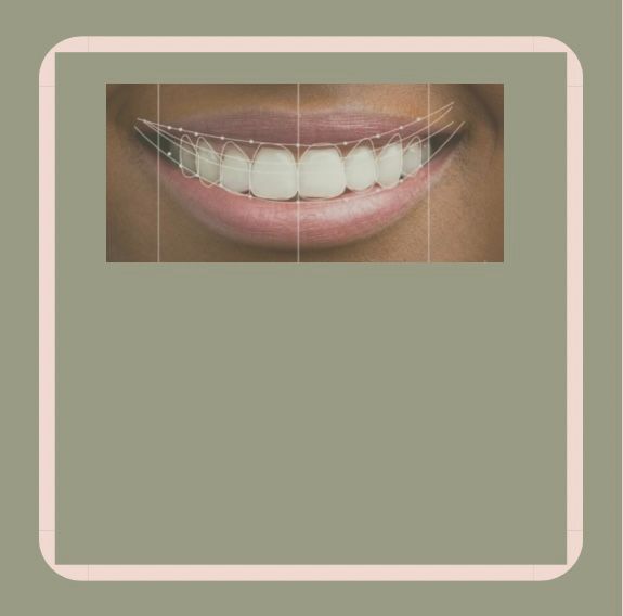 Smile Design